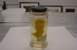 Un intestin de 200 ans révèle une souche ancienne du choléra